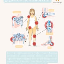Bursitis